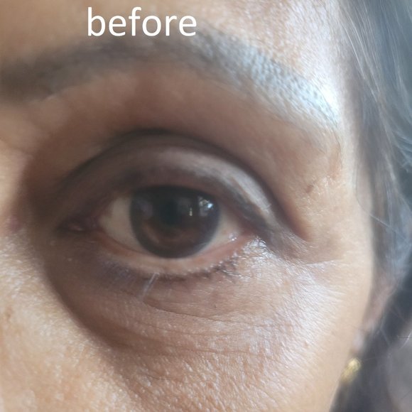 Collagen Lip and Eye Masks - Picture 4 of 6